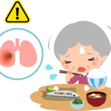 月島（中央区佃）の歯医者、佃2丁目歯科で、親の「むせ込み」を見逃さないで。誤嚥性肺炎のリスクを下げるための口腔ケア