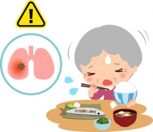 月島（中央区佃）の歯医者、佃2丁目歯科で、親の「むせ込み」を見逃さないで。誤嚥性肺炎のリスクを下げるための口腔ケア