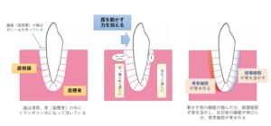 月島（中央区佃）の歯医者、佃2丁目歯科で、疲れがたまると歯が浮いた感じがするのはなぜ？原因やリスクを解説