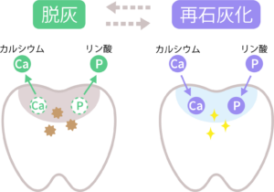 月島（中央区佃）の歯医者、佃2丁目歯科で、長く自分の歯で食事を楽しむためのコストとは？ 治療の繰り返しを防ぐ「予防投資」の考え方を解説