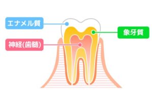 月島（中央区佃）の歯医者、佃2丁目歯科で、知覚過敏と虫歯の見分け方とは？しみ始める原因と自宅でできるケア方法を解説