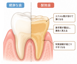 月島（中央区佃）の歯医者、佃2丁目歯科で、長く自分の歯で食事を楽しむためのコストとは？ 治療の繰り返しを防ぐ「予防投資」の考え方を解説