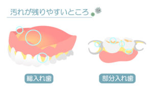 月島（中央区佃）の歯医者、佃2丁目歯科で、入れ歯の汚れ、取りきれてる？正しいお手入れ法と歯科医院でのメンテナンスの必要性を解説